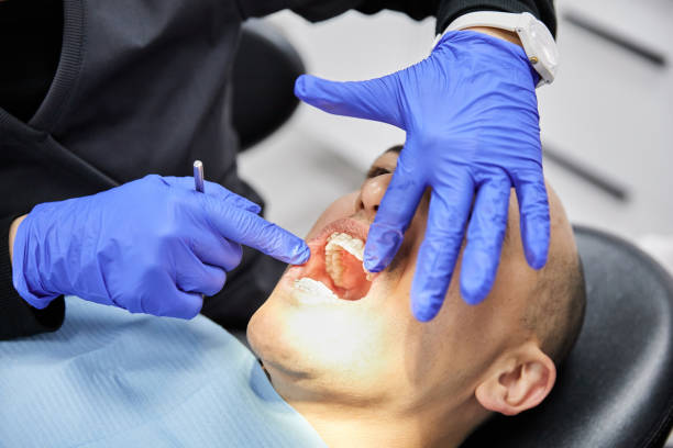 Best Teeth Whitening  in Greenville, MI